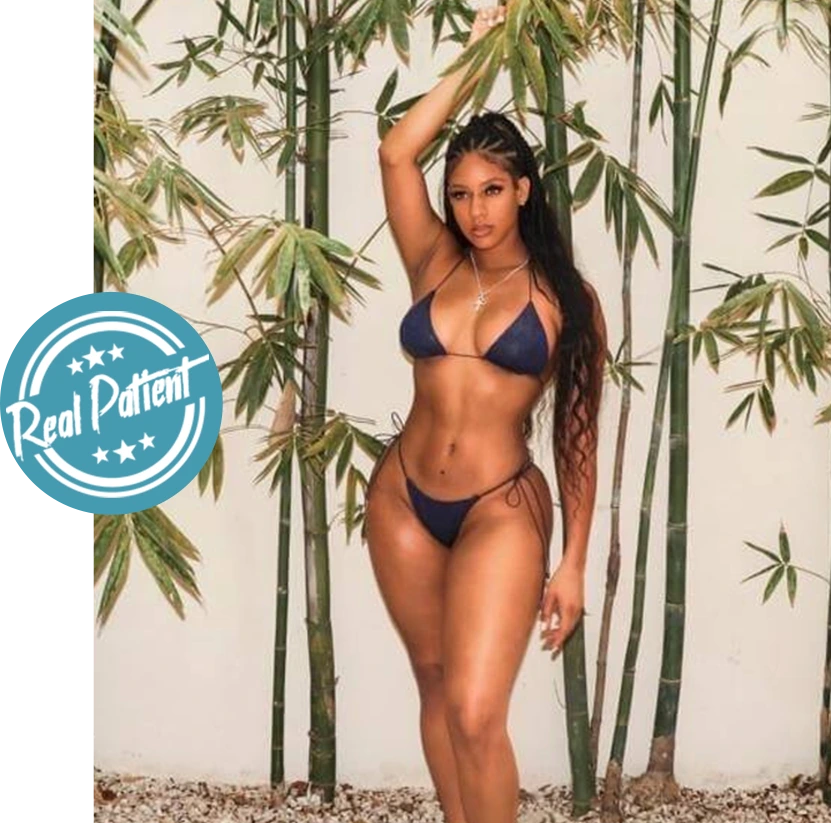 Lipo 360 + BBL⁣⁣⁣ Before & After