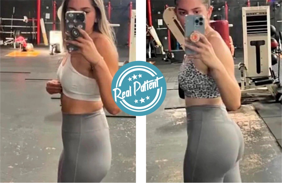 THE ATHLETIC BRAZILIAN BUTT LIFT technique banner