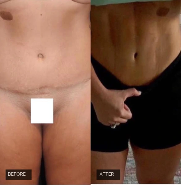 Before & after Banner