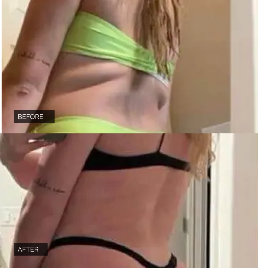 Before & After Real Patient Banner
