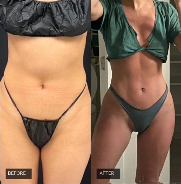 Before & After Real Results Banner