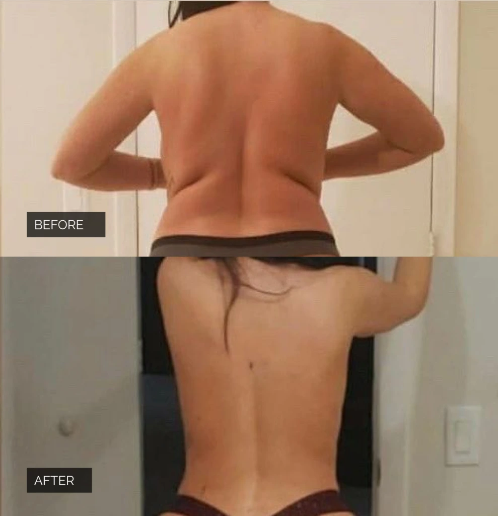 Before & After Results Case Banner